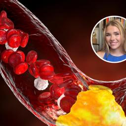 Carlota Serra, farmacéutica: "Un colesterol total alto no siempre significa que tengas más riesgo"