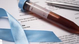 Si se prohibieran hoy, tu sangre tardaría una década en limpiarse: la realidad de los químicos eternos según la ciencia