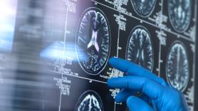 José López Barneo, catedrático de Fisiología y pionero en la investigación de las células madre: "Si todos viviéramos 120 o 130 años, acabaríamos con alzhéimer y Parkinson. El cerebro no puede regenerarse"