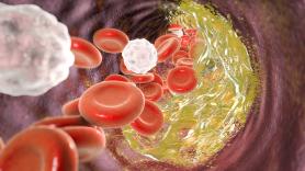 Jean-François Chenot, profesor de medicina: "La dieta tiene una influencia mínima en el colesterol"