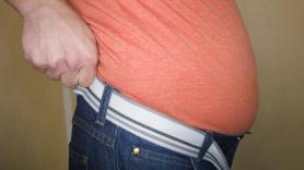 Javier Gómez-Ambrosi, investigador: "El IMC puede infraestimar el riesgo en personas con peso normal pero alta adiposidad, lo que llamamos obesidad oculta"