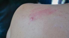 Guillem Pons, experto en biología, sobre la araña violinista que ha dejado a una joven ingresada durante 10 días: "Es una especie muy común que puede estar en cualquier lugar"