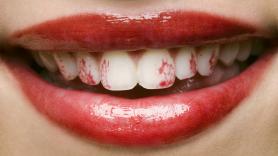 El pintalabios ya no es para gustarles a ellos: por qué Chappell Roan se mancha los dientes de carmín a propósito