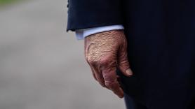 Trump se maquilla la mano antes de cada acto público y dice que tarda "unos 10 segundos": el moratón que lleva un año exacto generando preguntas sobre su salud