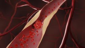 Los médicos de familia coinciden: el 20% de los españoles tiene elevada una proteína del colesterol que casi ningún hospital público analiza