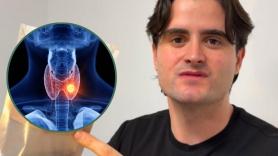 Unai Dueñas, experto en tiroides: "Para saber cómo tienes el tiroides en 30 segundos necesitas una silla, un espejo y un vaso de agua"