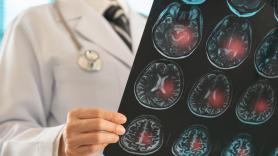 Doctor Bueno: "Ni se te ocurra ignorar un hormigueo en las manos al levantarte: puede ser el aviso previo de un ictus, igual que la angina lo es del infarto"