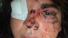 Una mujer transexual, Miss Trans Zamora, denuncia una brutal paliza grupal en La Bañeza (León)