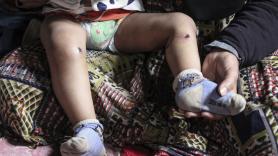 Un bebé gazatí sufre heridas y una quemadura de cigarrillo tras ser retenido por Israel