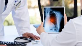 Es oficial: la OCDE calcula que el COVID persistente costará 135.000 millones de dólares al año para sus economías