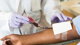 Confirmado por DARPA: la sangre en polvo para heridos en combate funciona en animales y podría estar lista para soldados en 2029, si se resuelve antes el coste