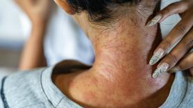 Un estudio con 120 prendas compradas en España encontró formaldehído en un 20% de la ropa de bebé y premamá: los dermatólogos explican por qué es buena idea lavar siempre la ropa nueva antes de ponérsela