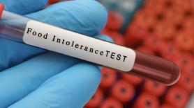 Theresa MacPhail, antropóloga médica: "Los test de intolerancia alimentaria IgC son inútiles, los especialistas en alergia los odian y dicen en privado que no son más que aceite de serpiente caro"