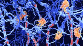 Una investigadora española firma en Nature un avance contra el Alzheimer, el Parkinson y la esclerosis múltiple: la inflamación cerebral es también el primer paso de la reparación