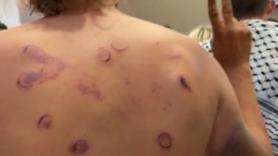 Las imágenes de las torturas de Israel a los activistas de la Flotilla: "un lugar de terror"