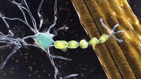 Un paciente paralizado por ELA vuelve a hablar con su familia gracias a un implante cerebral
