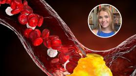 Carlota Serra, farmacéutica: "Un colesterol total alto no siempre significa que tengas más riesgo"