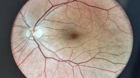 Durante más de cien años se pensó que no existía; ahora se ha encontrado un "sistema de eliminación de residuos" en la parte posterior del ojo