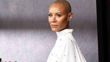 El infierno de las personas con alopecia areata y el fármaco que llega para rescatarlas