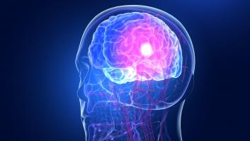 Un nuevo estudio asombra al descubrir las tres desconocidas causas del ictus