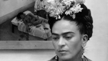 Diagnostican, 70 años después de su muerte, cuál era la afección de Frida Kahlo