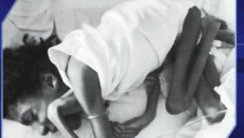 Chicago: Una niña minusválida de 16 años llegó a pesar diez kilos tras pasar meses sin alimentos