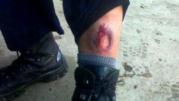 El SUP denuncia que los mandos de la Policía instan a disparar pelotas de goma directamente a los ciudadanos (FOTOS, VÍDEOS)