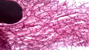 Fotografías de ciencia: la imágenes de la investigación del Cáncer del CNIO (FOTOS)