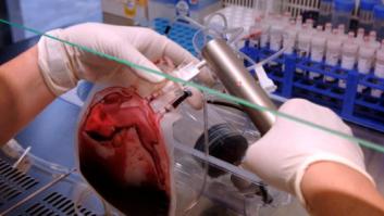 La crisis reduce en un 30% el número de familias que pagan por conservar el cordón umbilical de sus hijos