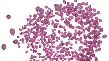 La otra opción, o cuando la vida te enseña que hay que aprovecharla