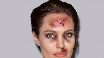 Un artista convierte a mujeres famosas en víctimas de violencia machista (FOTOS)