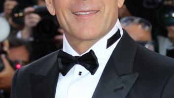 Siete cosas que debes saber sobre el hecho de quedarse calvo