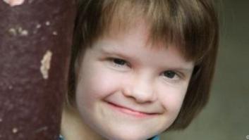 Investigación sobre el síndrome de Down: un gen podría neutralizar el cromosoma responsable