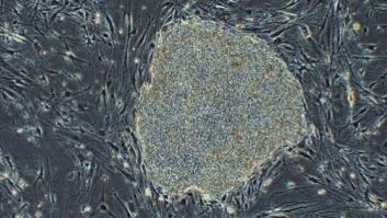 Primer ensayo en humanos con células madre iPS: nueva fase de medicina regenerativa en Japón