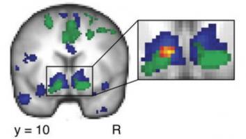 Facebook activa la misma zona del cerebro que el sexo, la comida o el dinero