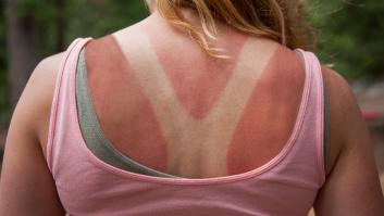 Cómo proteger nuestra piel (y ojos) del sol