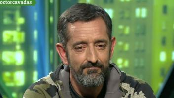 Cavadas deja de operar en la sanidad pública para hacerlo en la privada