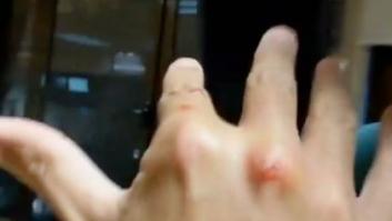 "No os podéis imaginar cómo me duele la mano": El percance que ha sufrido el 'hombre del tiempo' de TVE