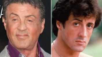 Actores operados: ellos también pasan por el quirófano (FOTOS)