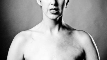 Proyecto Cicatriz: 12 fotos de mujeres reales tras vencer el cáncer de mama (FOTOS)