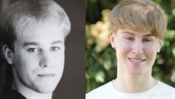 Un fan de Justin Bieber gasta 70.000 euros en cirugía plástica para parecerse a su ídolo (FOTOS)