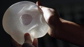 Implantes PIP mamarios: Sanidad recomienda a las mujeres con estas prótesis que se las quiten