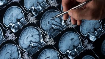 De las migrañas al cáncer: Inteligencia artificial para diagnosticar enfermedades