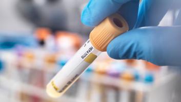 La OMS advierte de un brote de hepatitis mundial "de origen desconocido" que afecta a los niños