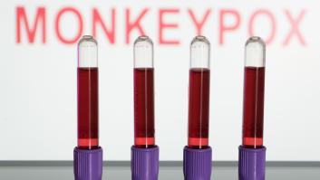 Sanidad confirma la segunda muerte por viruela del mono en España