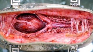 La brutal campaña de PETA que muestra lo que esconde tu bolso de piel