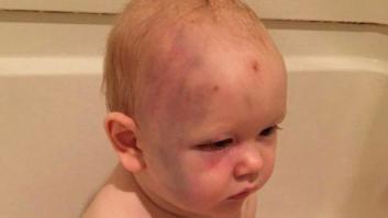 Unos padres recurren a Facebook en busca de justicia: maltrato impune porque el niño no habla