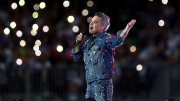 Robbie Williams cuenta cómo ha llegado a aceptar su calvicie