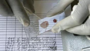 Alemania del Este vendió sangre de presos para conseguir divisas