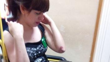 Los candidatos de Pacma en Granada, agredidos en la pegada de carteles